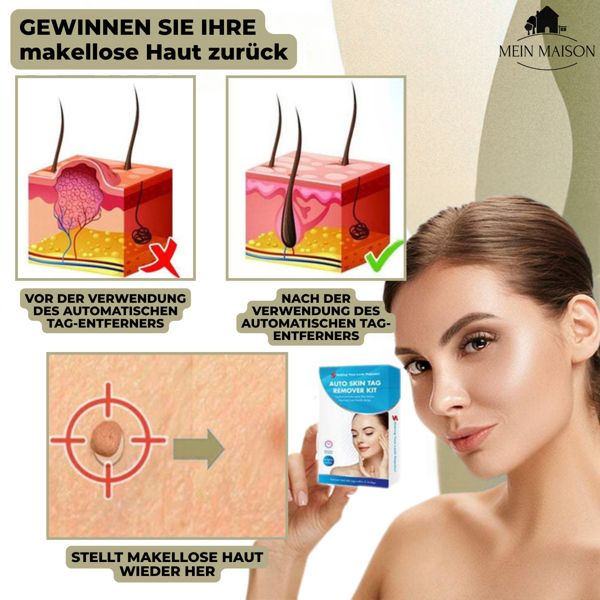 Niropi | DermaLinx Wart Remover | Pain-Free Removal of Warts & Moles | For Home | Without Surgery