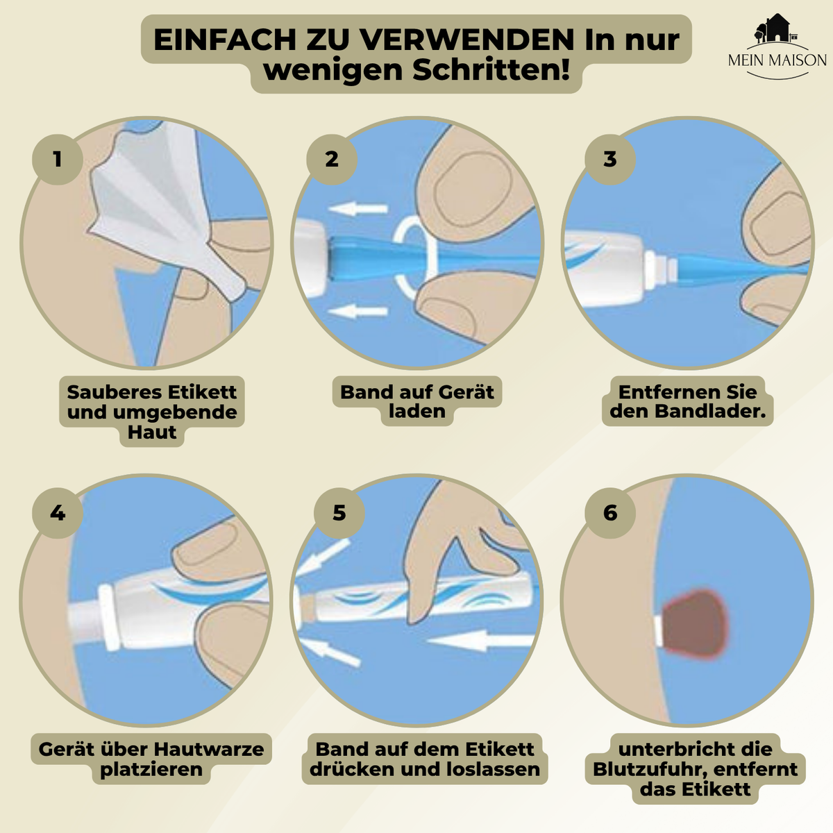 Niropi | DermaLinx Wart Remover | Pain-Free Removal of Warts & Moles | For Home | Without Surgery