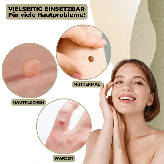 Niropi | DermaLinx Wart Remover | Pain-Free Removal of Warts & Moles | For Home | Without Surgery