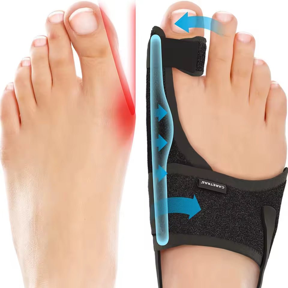 Niropi | Night Splint Hallux Valgus - Ergonomic and Adjustable Comfort