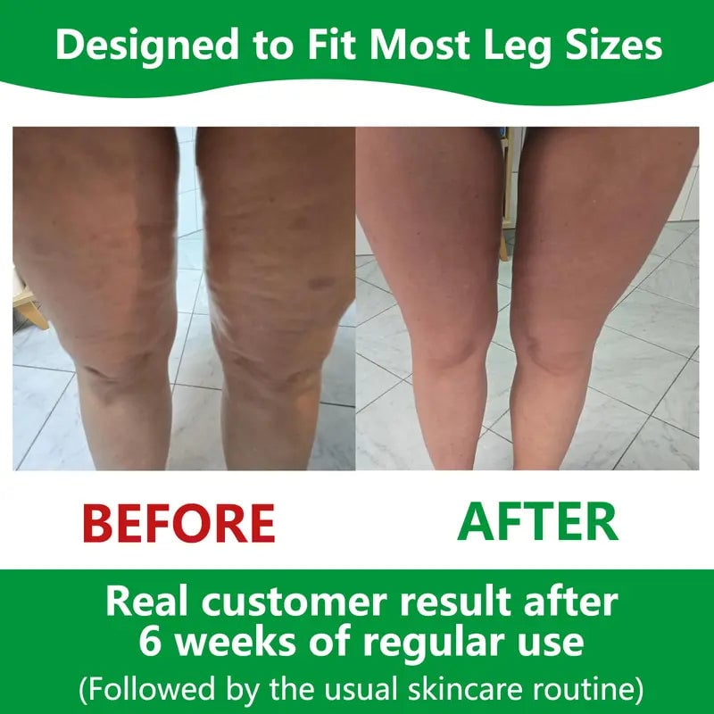 Niropi | Sakerplus Cellulite Massage Roller