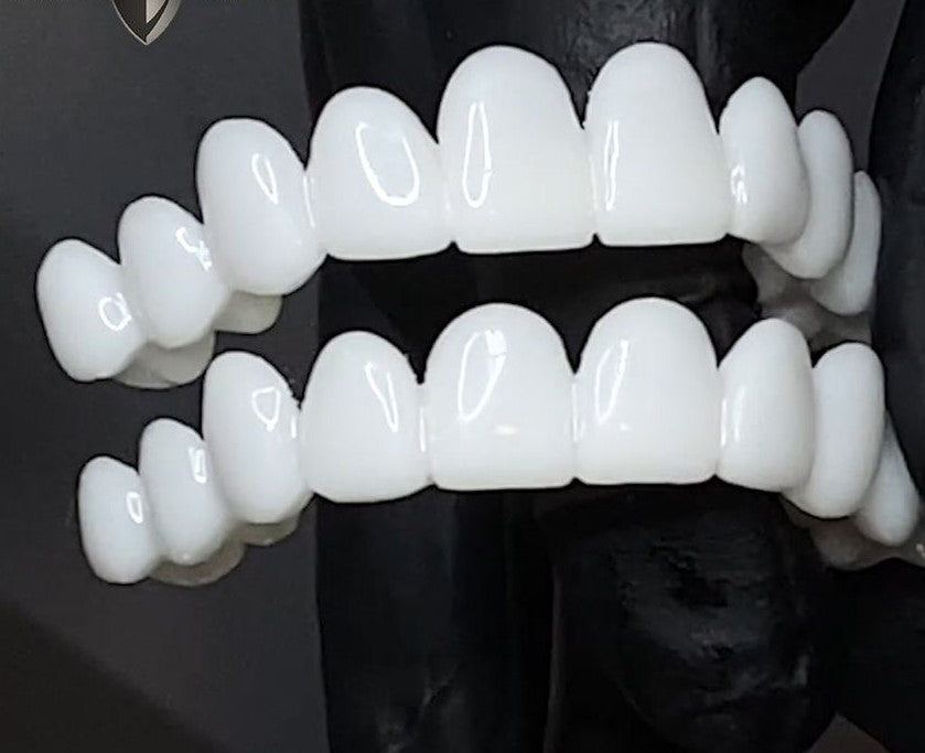 Niropi | Snap-On Cosmetic Veneers | Instant Smile Cover for Imperfections