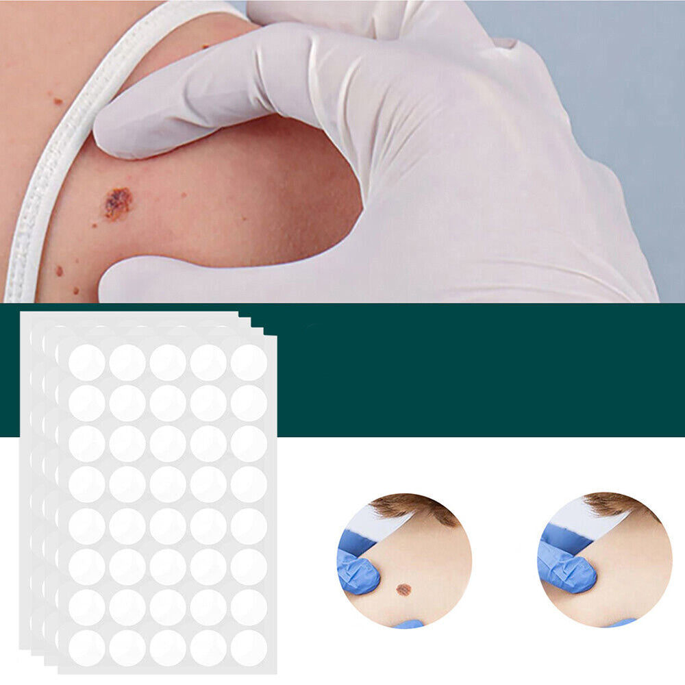 SkinClear - Patch for the removal of spots and warts Niropi