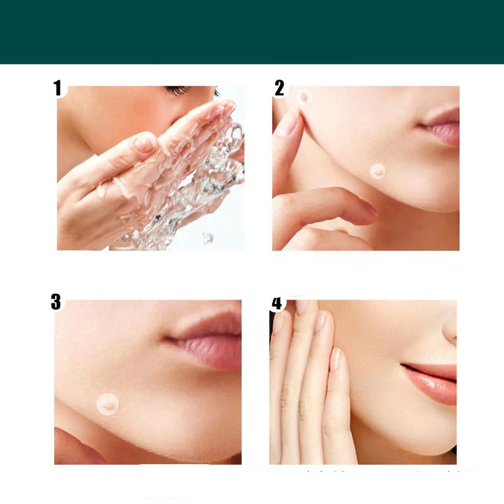 SkinClear - Patch for the removal of spots and warts Niropi