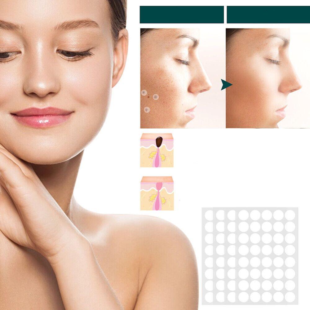 SkinClear - Patch for the removal of spots and warts Niropi