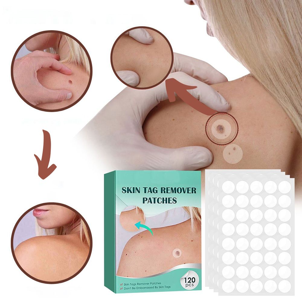 SkinClear - Patch for the removal of spots and warts Niropi